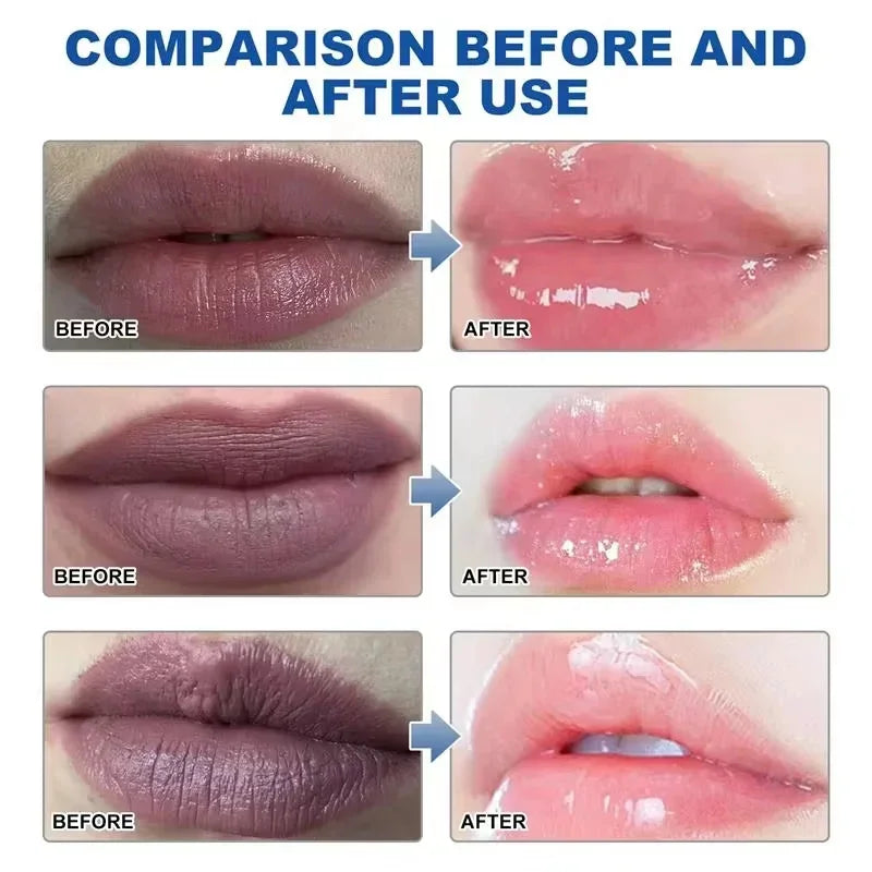 Korean Dark Lip Balm